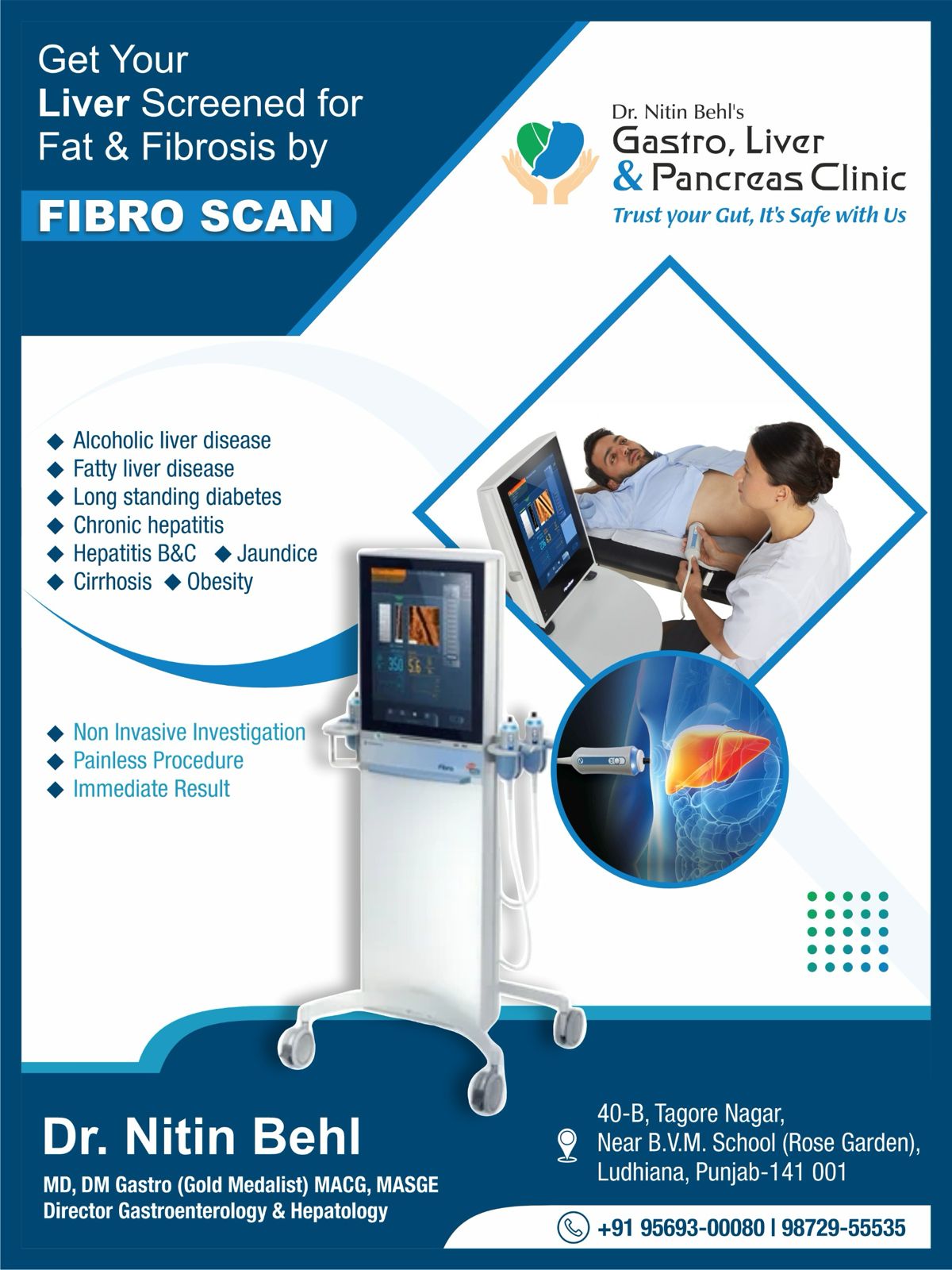 FIBROSCAN TEST